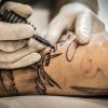 Risks and Benefits of Laser Tattoo Removal