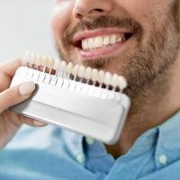 How Much Should I Spend on Dental Implants?