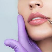 Can Dermal Fillers Cause Cold Sores?