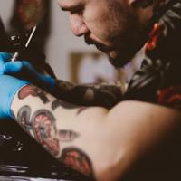 Common Tattoo Removal Questions