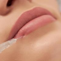 How Much Does it Cost to Get Lip FIllers?