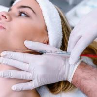 What Are Dermal Fillers?