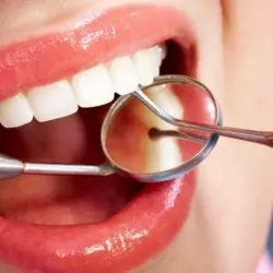 10 Smart Questions to Ask Before Getting a Dental Filling (That Most People Forget)